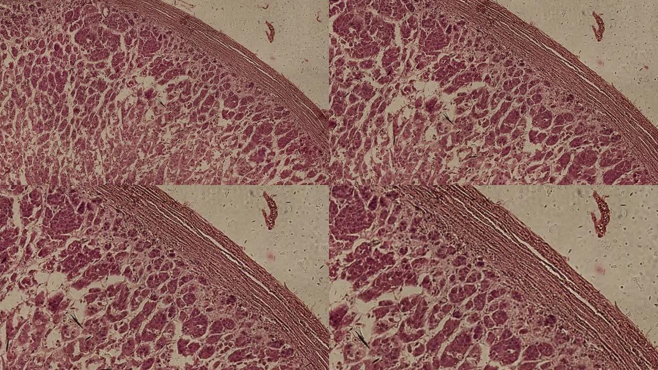 在显微镜下撞击和肿胀的人肝细胞的显微照片
