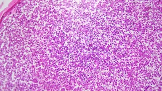 显微镜下拍摄的粉红色心室体，对明场放大200倍