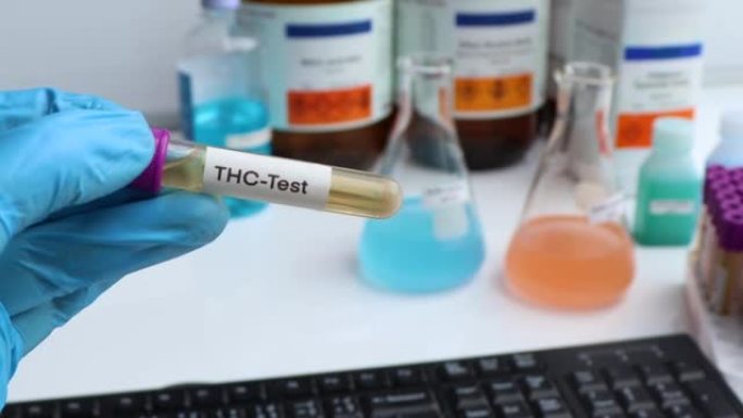 实验室测试THC的尿液样本