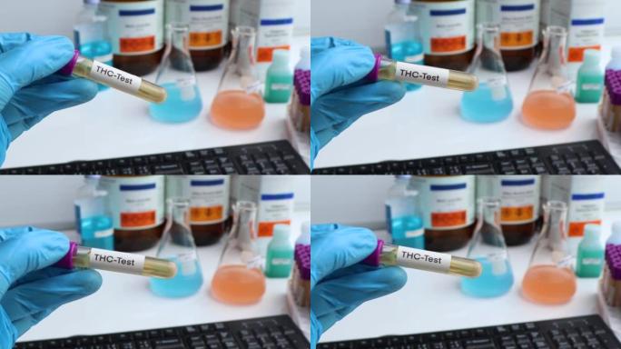 实验室测试THC的尿液样本