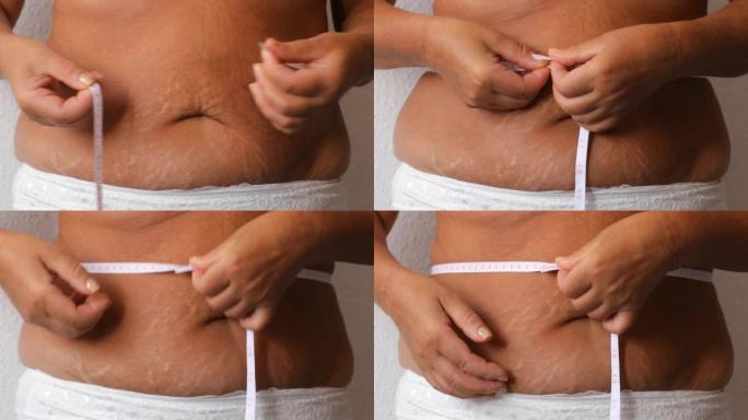 裸露的超重女人的内裤照片，试图减肥。用轮盘胶带拿着并测量她的腰围，腹部。肥厚的大下垂褶皱在肚子上。皮