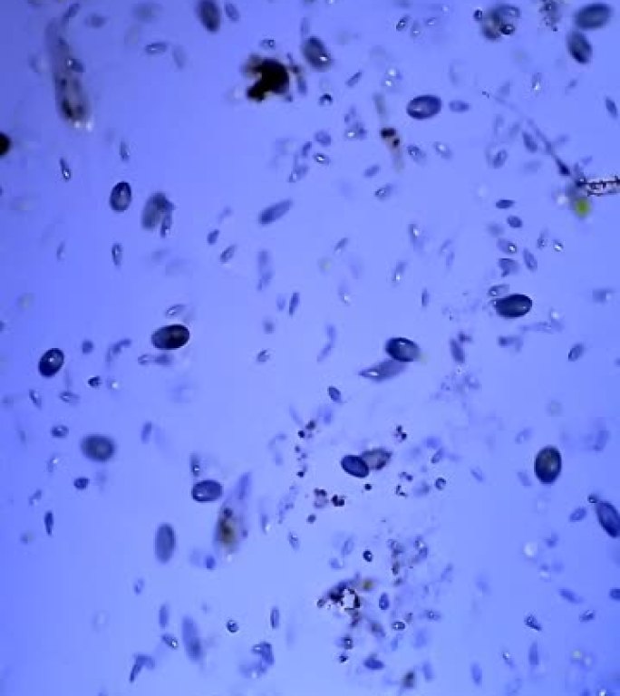 纤毛虫微生物菌落纤毛虫微生物菌落