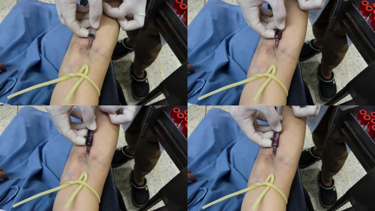医生或护士用真空吸尘器从手臂静脉采集血样。给病人静脉穿刺的注射器