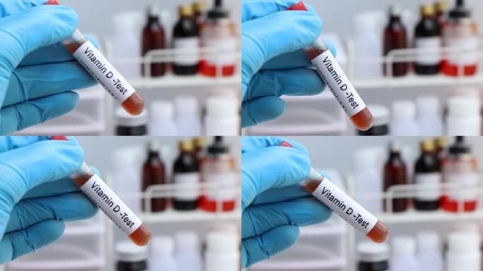 实验室检测维生素d的血液样本