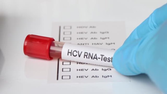 HCV RNA检测从血液中寻找异常