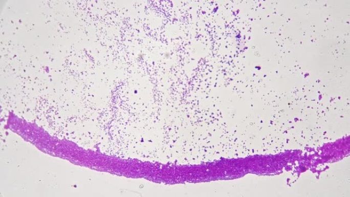 明亮视野背景下显微镜下的大肠杆菌涂片200倍科学载玻片