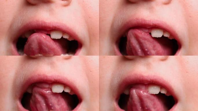 特写儿童无牙口的视频，显示牙齿和牙龈缺失的牙齿。弯曲，不稳定的牙齿护理