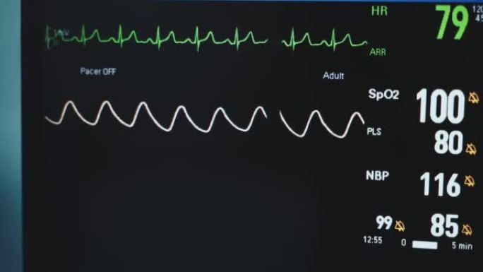 手术患者的生命迹象和参数。现代手术室里的黑色监视器特写镜头。