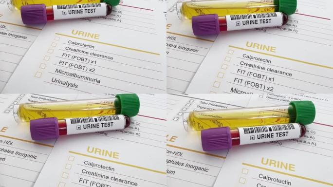 血液和尿管分析测试要求文件分析