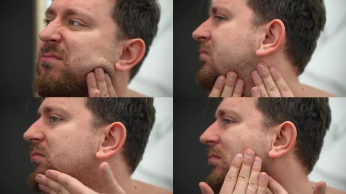 剃须后面部皮肤刺激，人用润肤油抚平受刺激的皮肤，用一次性剃刀去除刷毛后的圆形运动来镇静受刺激的皮肤
