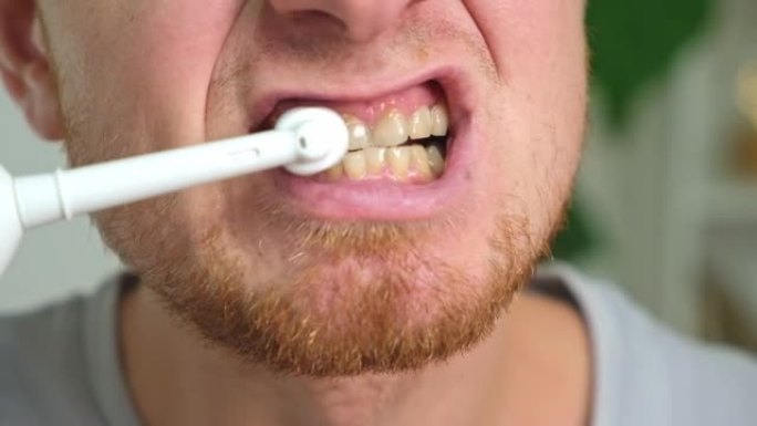 一个留着红胡子的年轻人正在用白色电刷刷牙。口腔护理。
