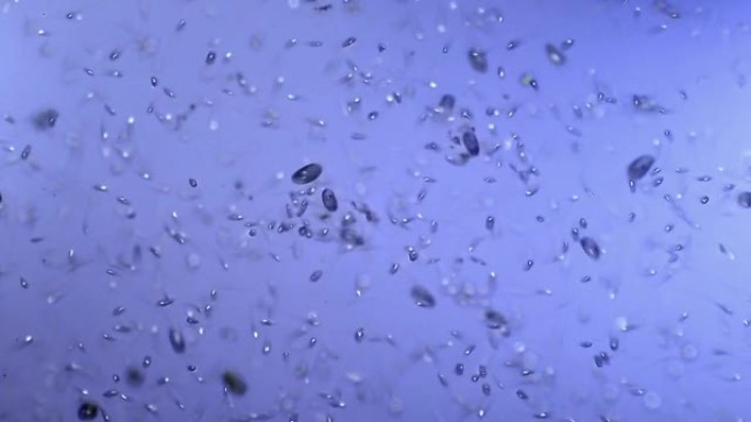 纤毛虫微生物菌落纤毛虫微生物菌落