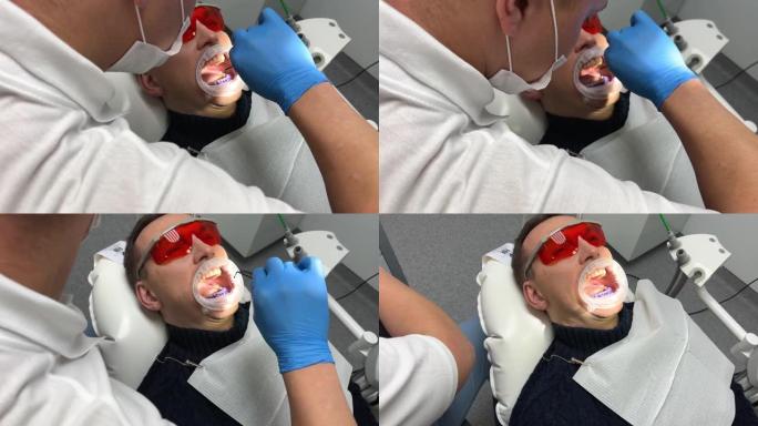 在诊所牙医为坐在椅子上的病人工作时，进行牙齿清洁和抛光。戴蓝色手套的医生将药膏涂在患者的牙齿上，以显