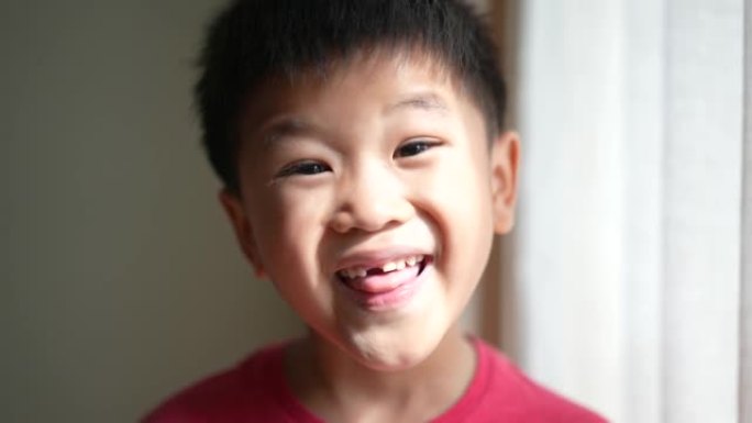 亚洲男孩展示他的乳牙和缺口牙。