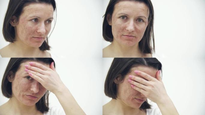 4k慢动作特写女性皮肤问题隐藏脸的视频。