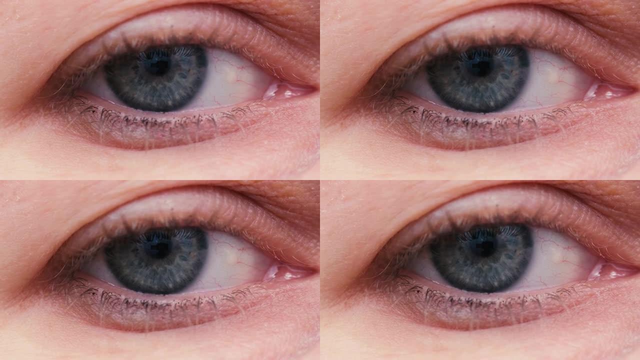 女人蓝灰色眼睛的特写。过度劳累使眼睛发红。