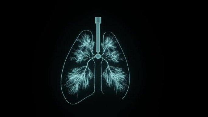 全息3D肺概念用于晚期肺部疾病的诊断和肺癌的个性化治疗
