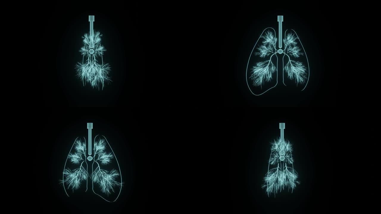全息3D肺概念用于晚期肺部疾病的诊断和肺癌的个性化治疗