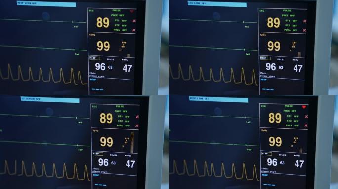 黑屏上的脉搏和心率参数。手术过程中病人的生命迹象。特写。