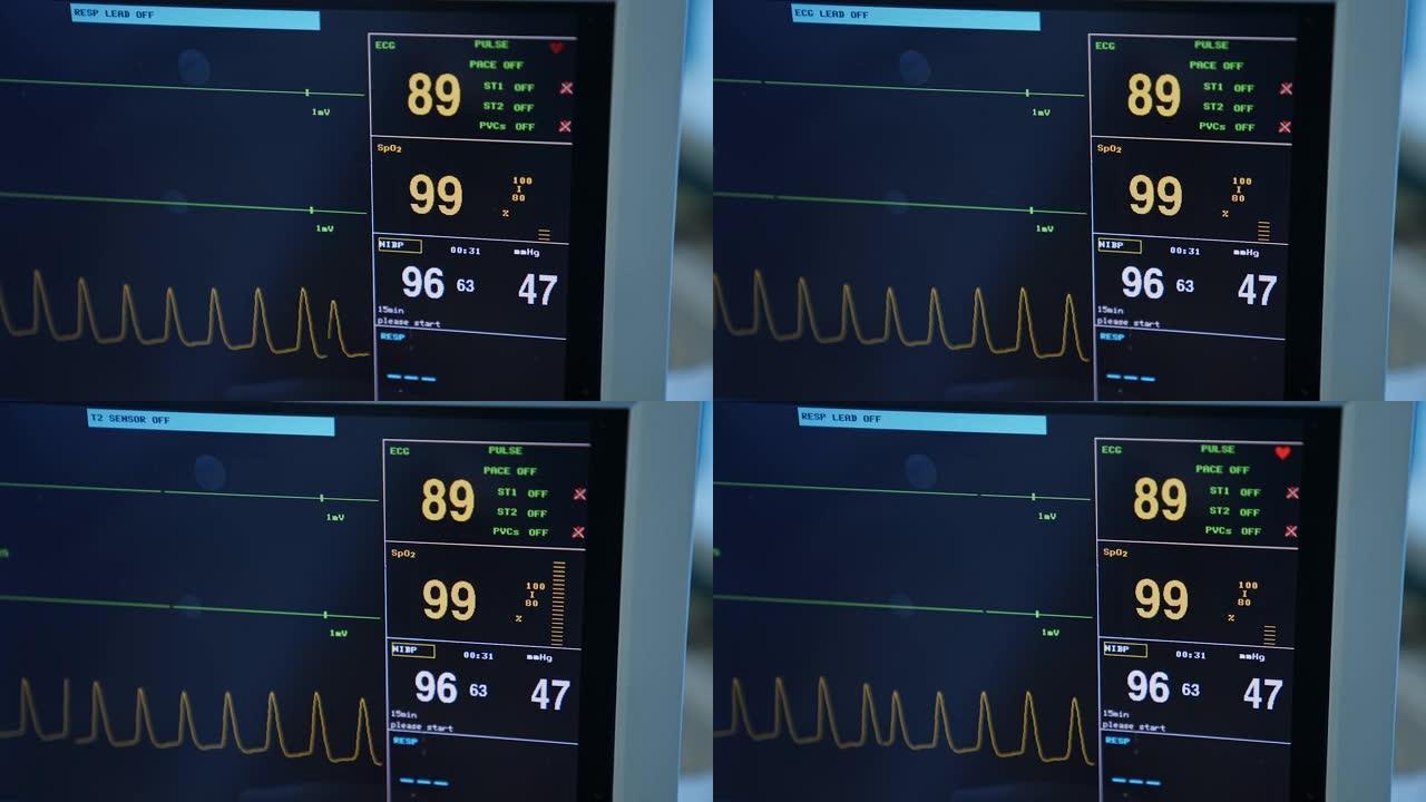 黑屏上的脉搏和心率参数。手术过程中病人的生命迹象。特写。