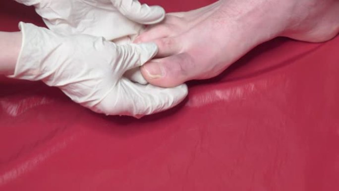 医生检查病人的脚趾疼痛。