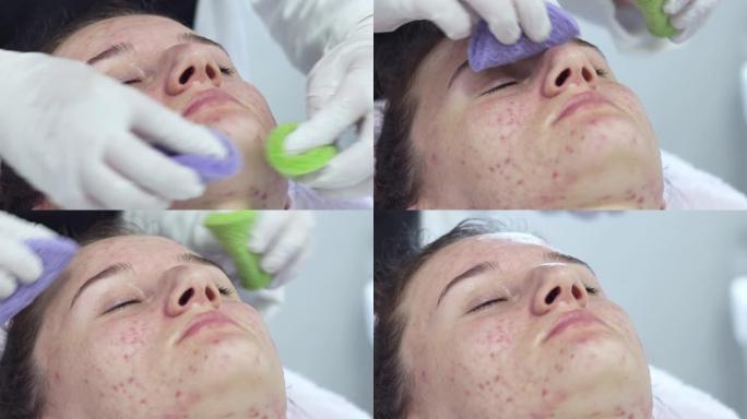 年轻女子在面部护理中使用特殊凝胶在美容水疗中心进行痤疮问题皮肤疗法
