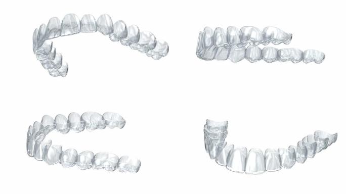 隐形支架或隐形固定器。医学上精确的牙科3D动画