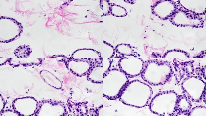 在400x显微镜下针对明场拍摄的人体甲状腺切片