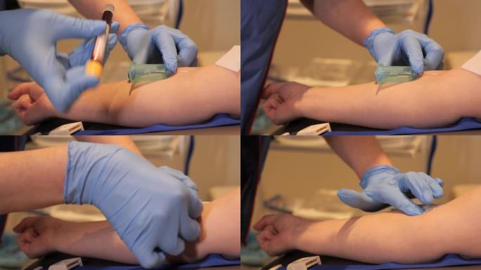 女医生戴着蓝色防护医用手套，从患者身上采集血样，进行医院冠状病毒检查。临床研究。诊所的实验室。Cov