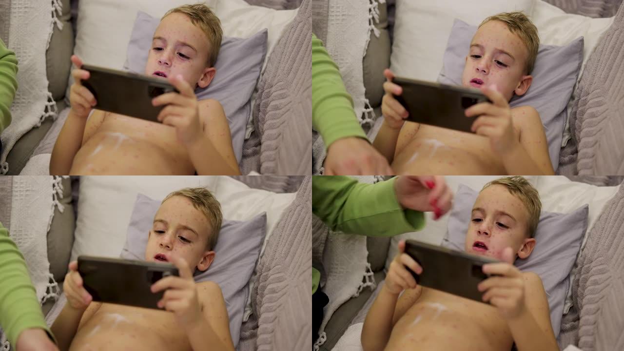 母亲在儿子的皮肤上涂上乳液，以减少水痘的瘙痒，同时他在手机上玩电子游戏