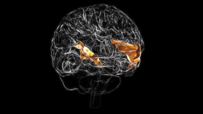 医学概念3D的颞上回解剖脑前部