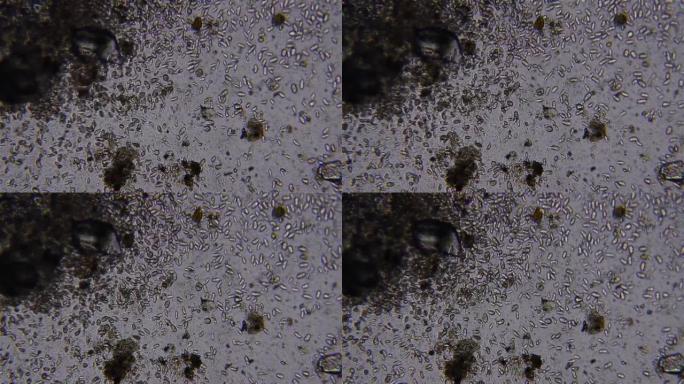 用光学显微镜观察到的搅动微生物12