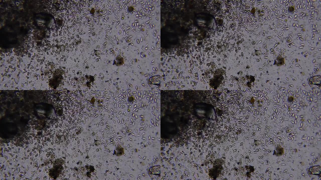 用光学显微镜观察到的搅动微生物12