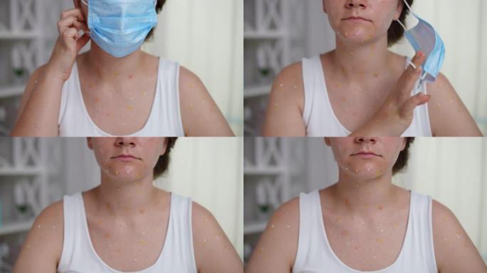 患有猴痘皮疹的年轻白人妇女在慢动作中脱下口罩。前视图无法辨认的女士，有感染病毒的症状，坐在室内。
