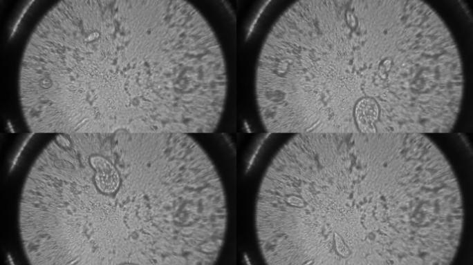 在微生物学小时的研究中看到光学显微镜的微生物