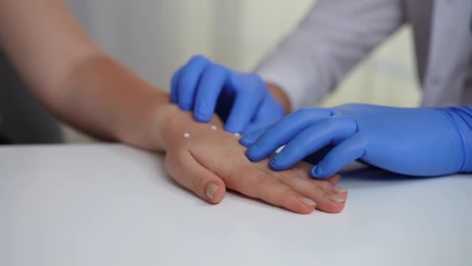 特写医生戴着手套检查女性手上的猴痘皮疹。无法识别的专业分析室内医院传染性传染病的症状。