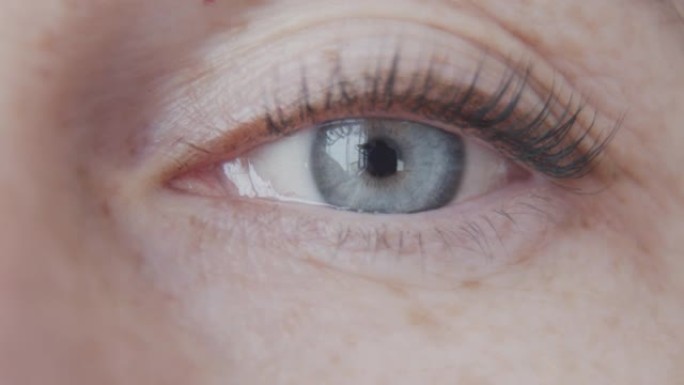 这个女人睁开了灰色的眼睛。脸左上侧的特写。雀斑的皮肤。眼角的小皱纹。眼球中的红色血管