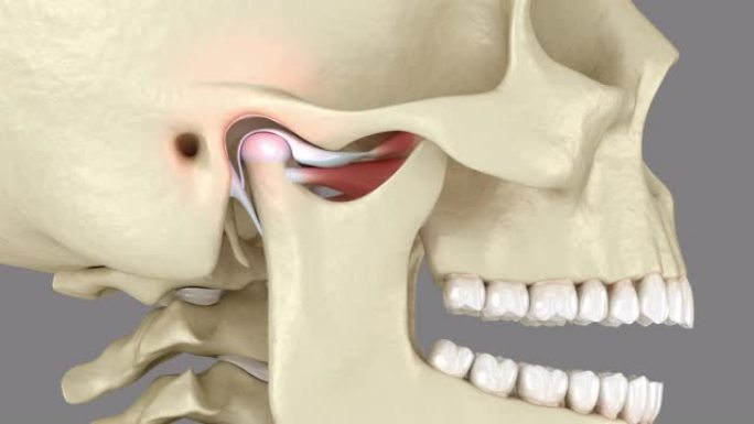 颞下颌关节和脱位关节盘。医学上精确的3D动画
