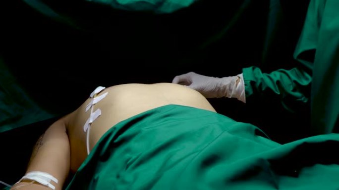 4K，男子躺在手术室，医生正在为等待手术的患者安装手术工具，将胸部贴在患者的躯干长管状器械上，用绿色