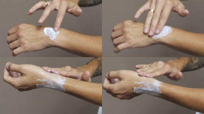 涂抹愈合霜的特写手部瘀伤，扭伤和手腕瘀伤