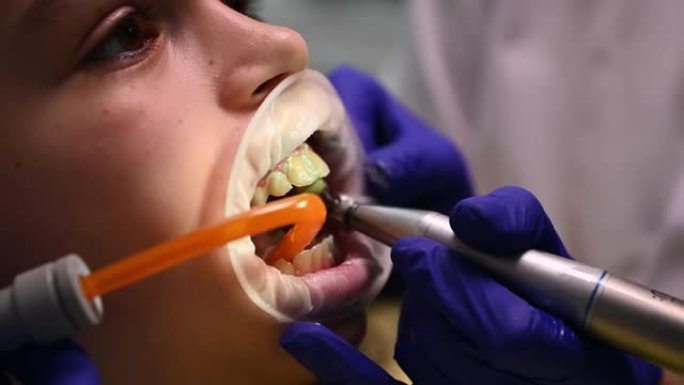 牙医在牙科诊所专业清洁牙菌斑和抛光儿童牙齿