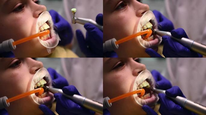 牙医在牙科诊所专业清洁牙菌斑和抛光儿童牙齿