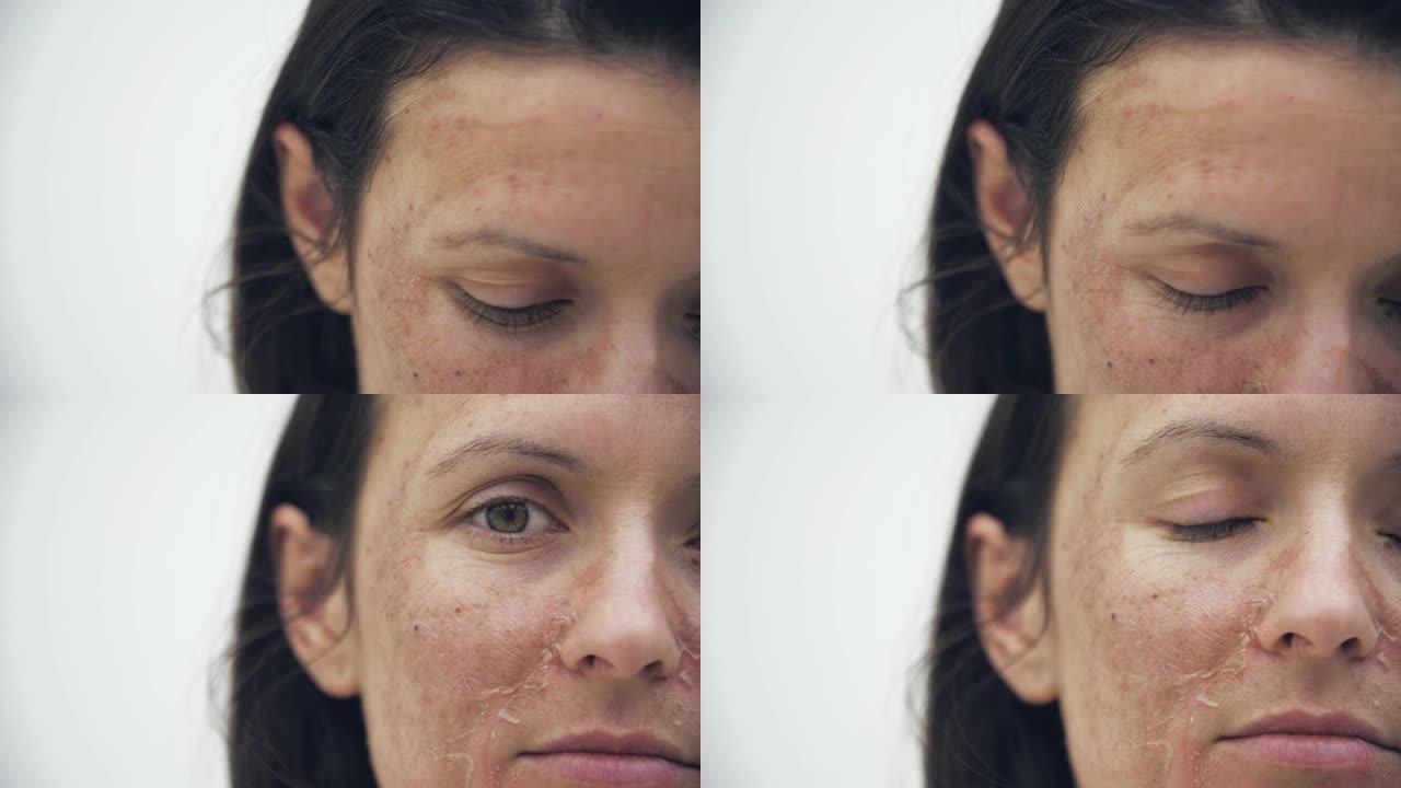 4k慢动作裁剪视频皮肤不好的女人。