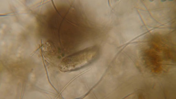 显微镜下的线虫，蛔虫中的寄生虫: 蛔虫，，线虫，旋毛虫。显微镜下饮用水中的细菌寄生虫和蠕虫。环境污染