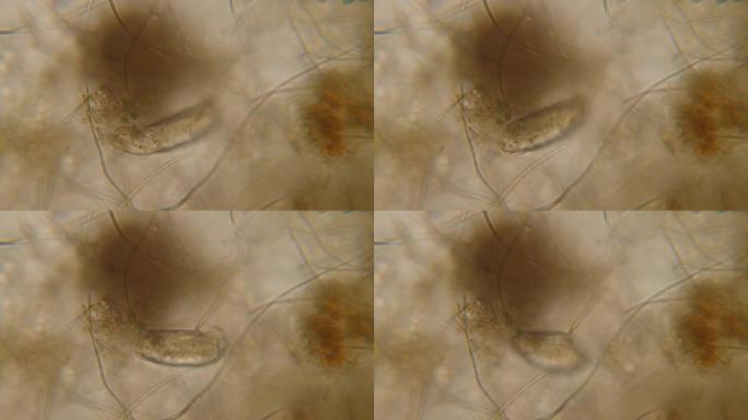 显微镜下的线虫，蛔虫中的寄生虫: 蛔虫，，线虫，旋毛虫。显微镜下饮用水中的细菌寄生虫和蠕虫。环境污染