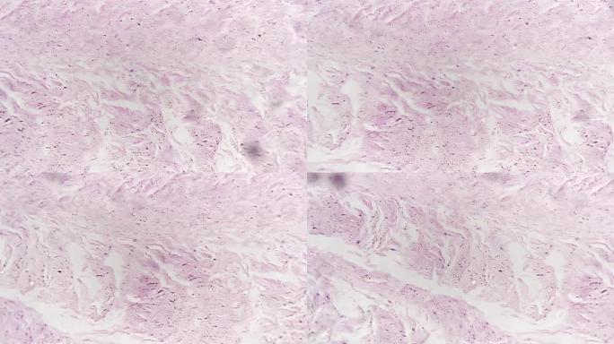 白底高倍400x拍摄人体纤维软骨切片