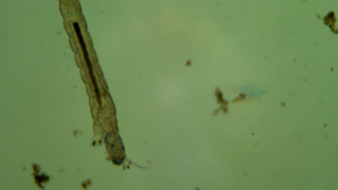 脏水中的微生物水生物采集试样显微镜分析