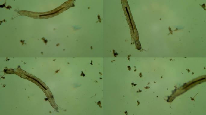 脏水中的微生物水生物采集试样显微镜分析