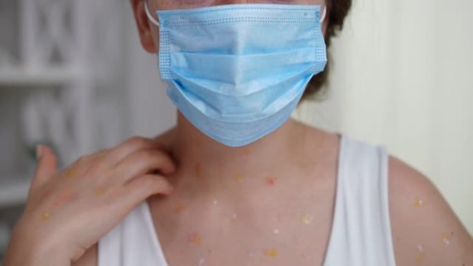 戴着口罩的女人在慢动作中抓挠脖子上的猴痘皮疹。前视图无法辨认的白人女性，室内皮肤发痒。