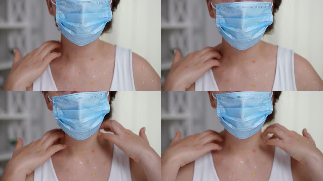 戴着口罩的女人在慢动作中抓挠脖子上的猴痘皮疹。前视图无法辨认的白人女性，室内皮肤发痒。